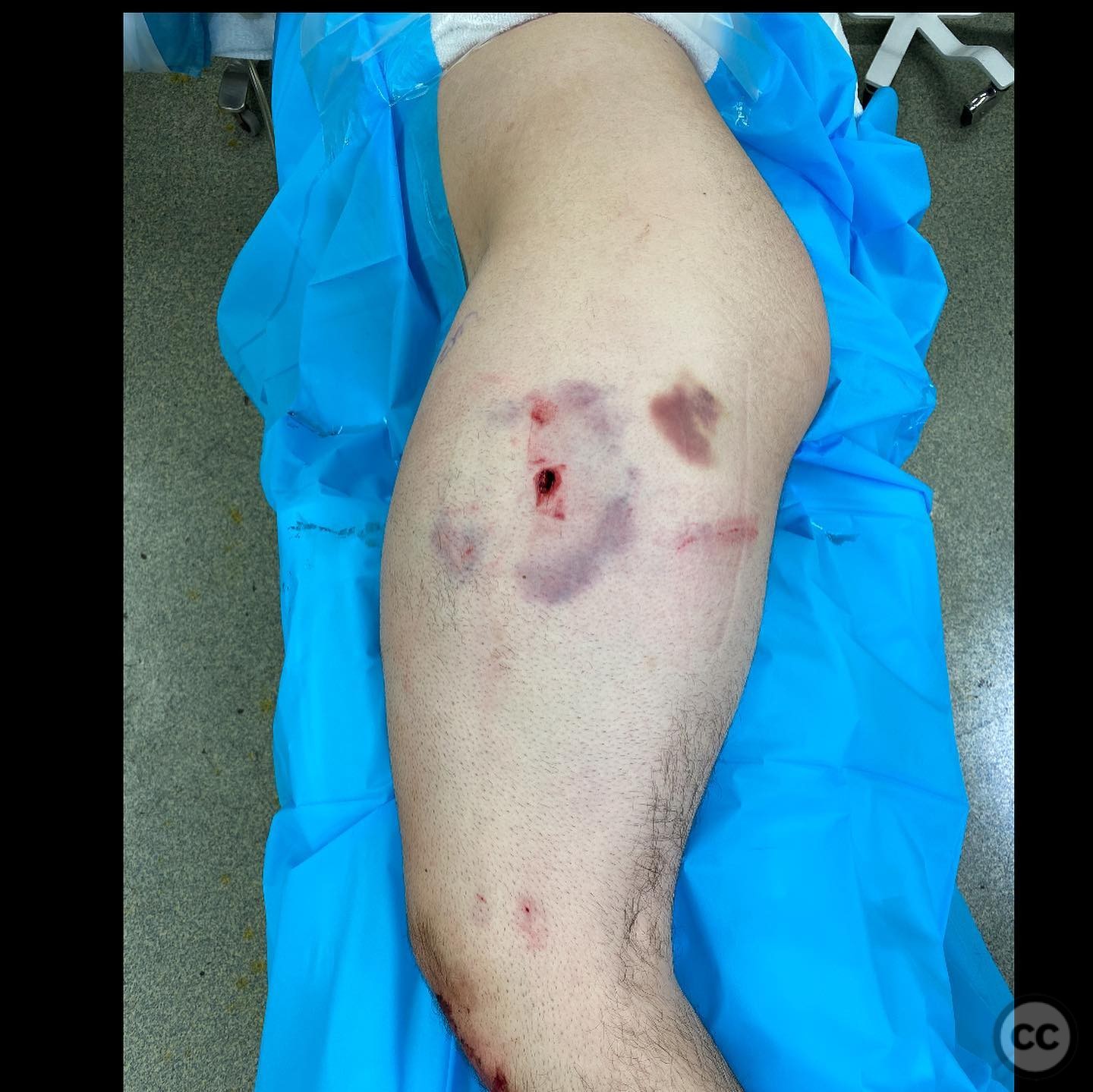 case image