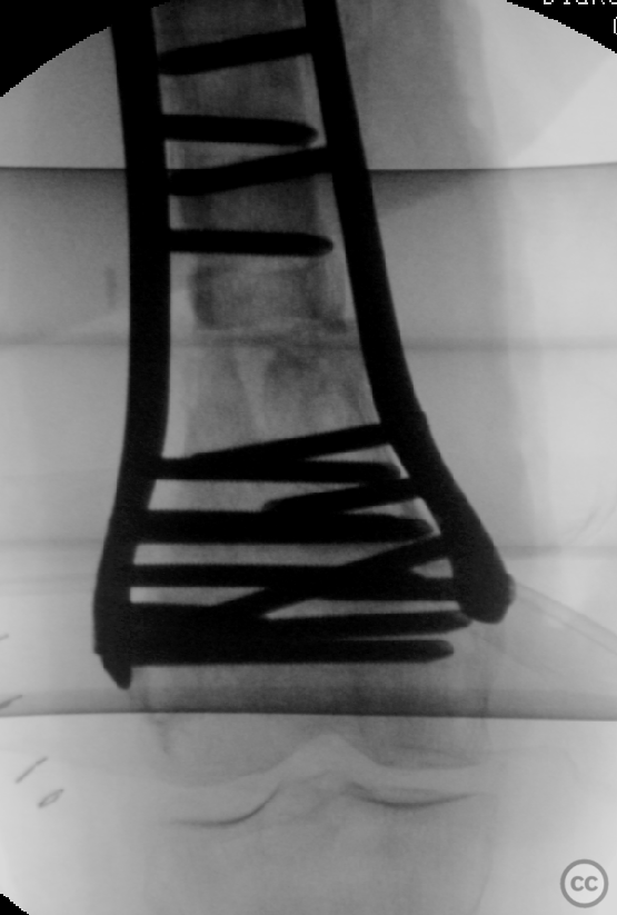 case image
