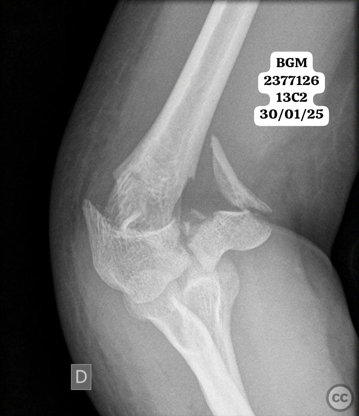 case image