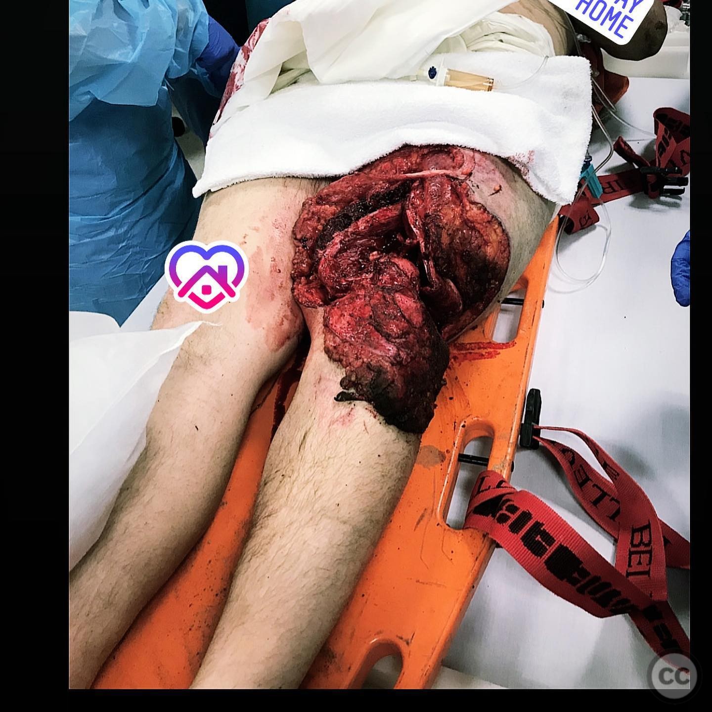 case image