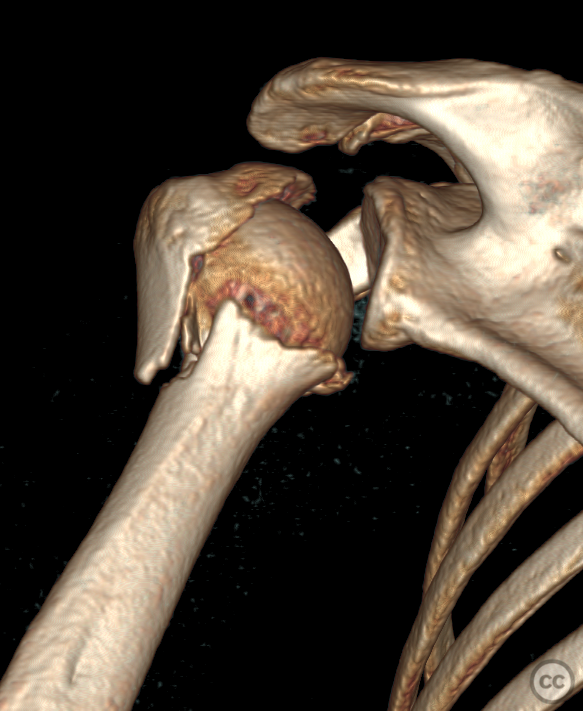 case image