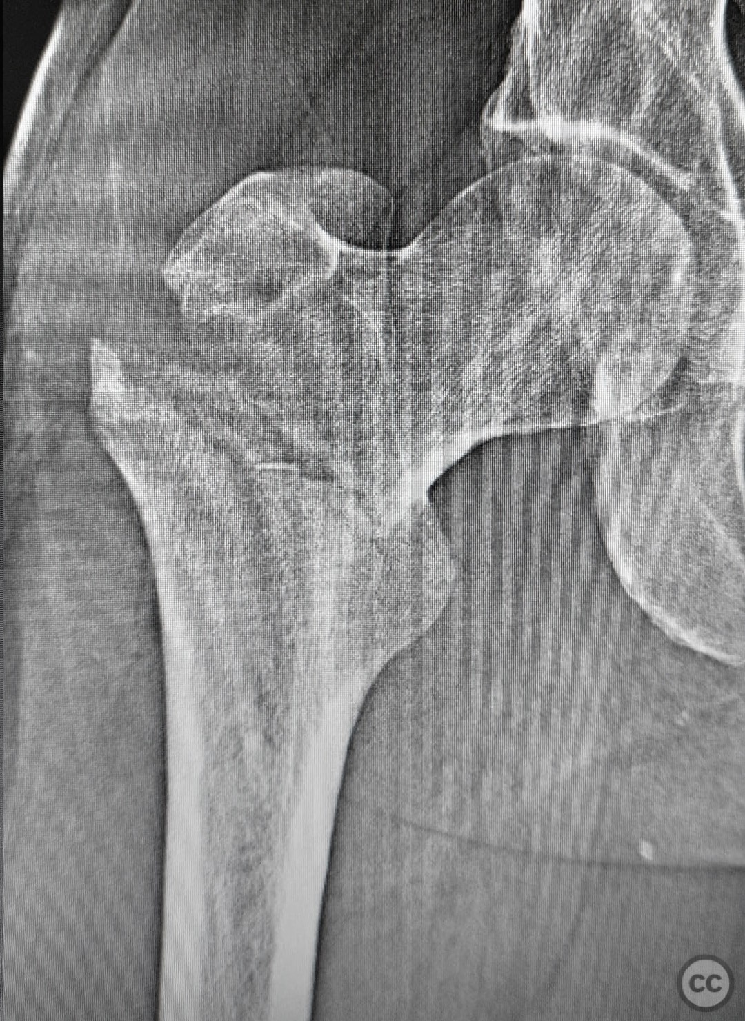 case image