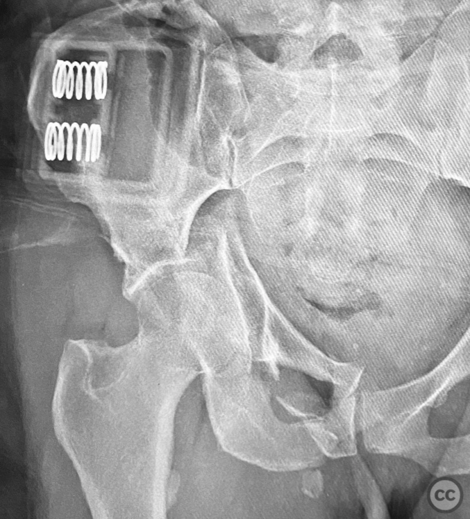 case image