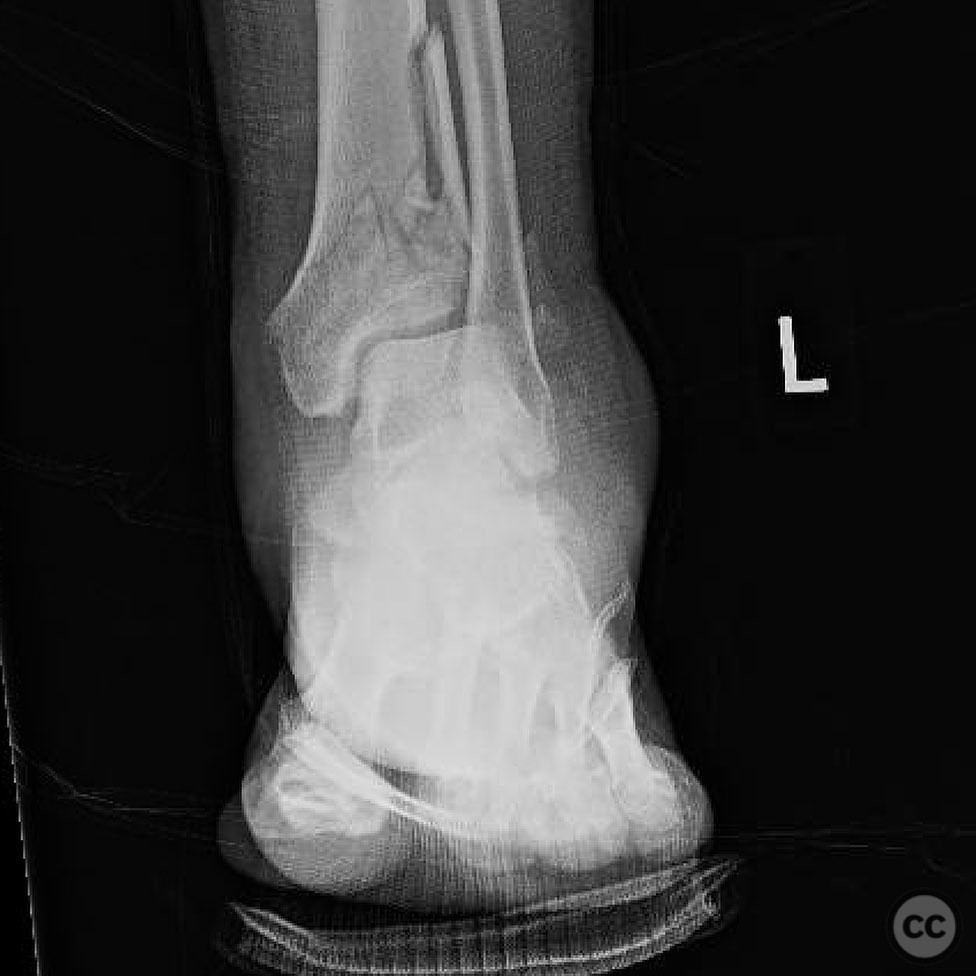 case image