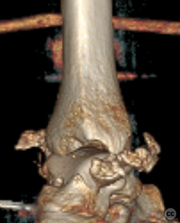 case image