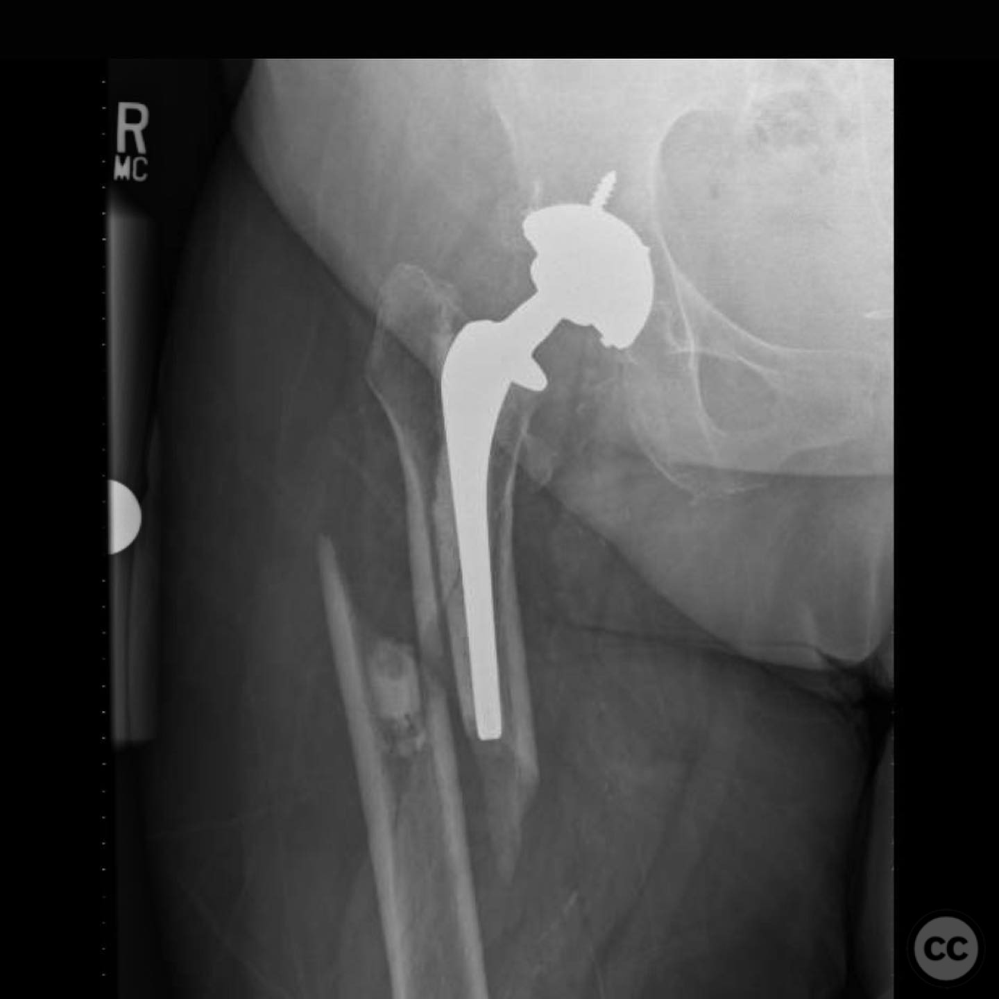 case image