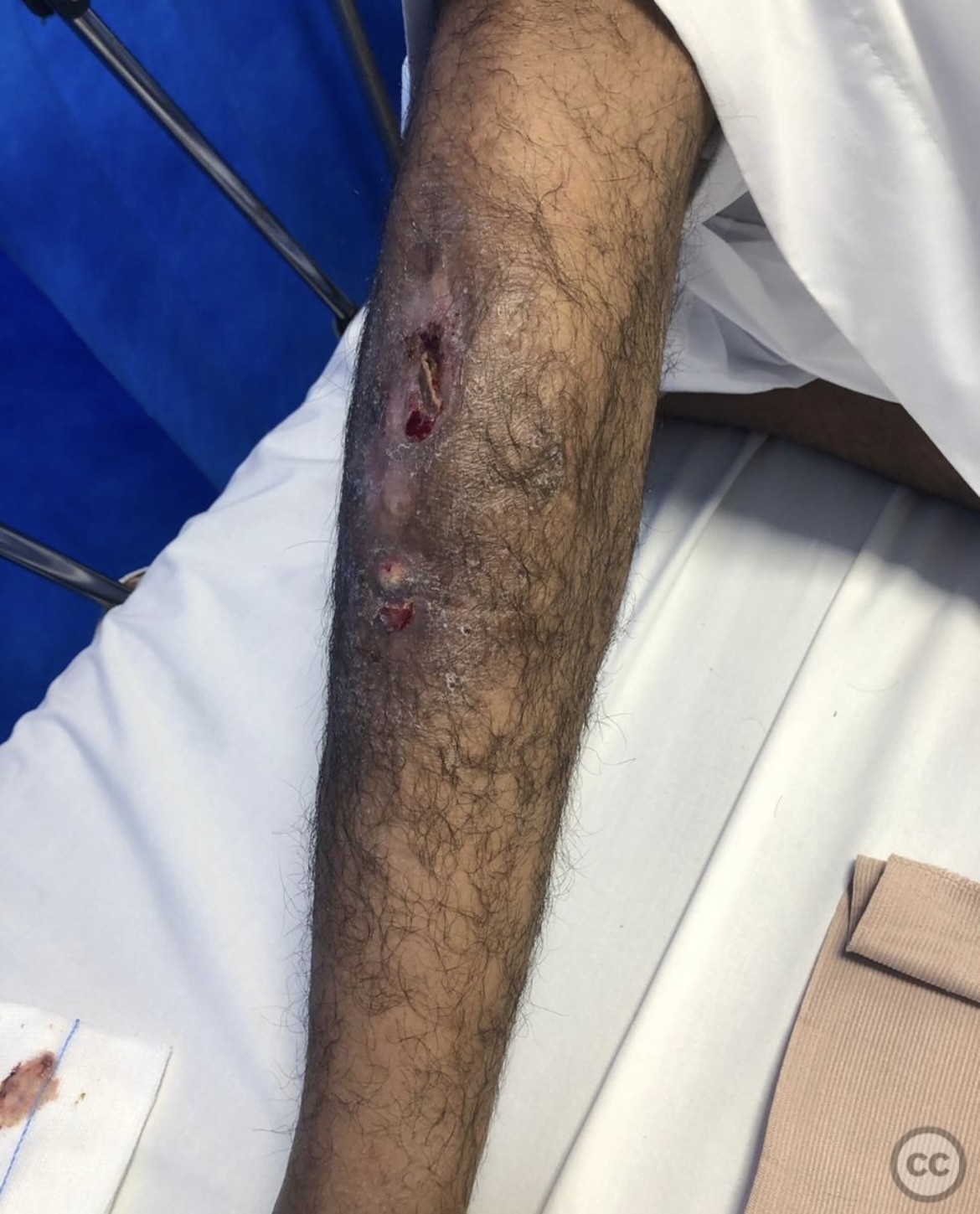 case image