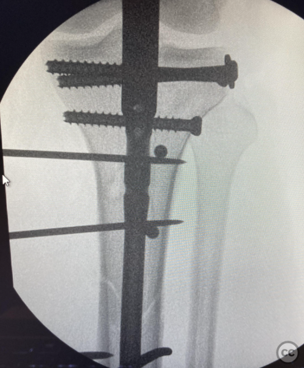 case image