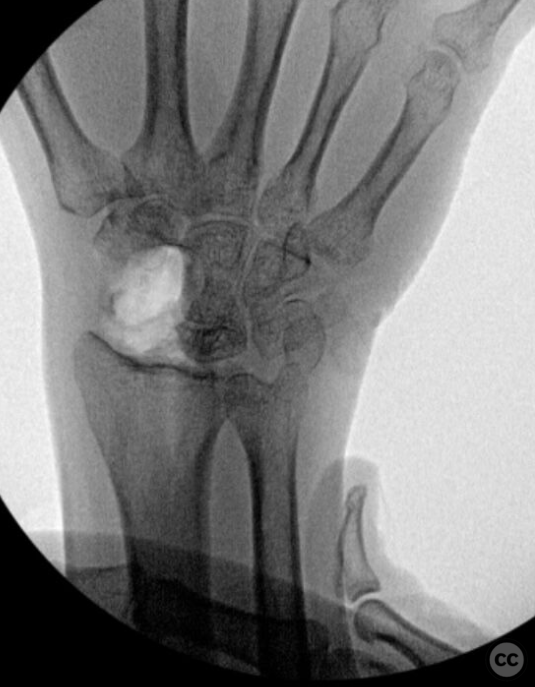 case image