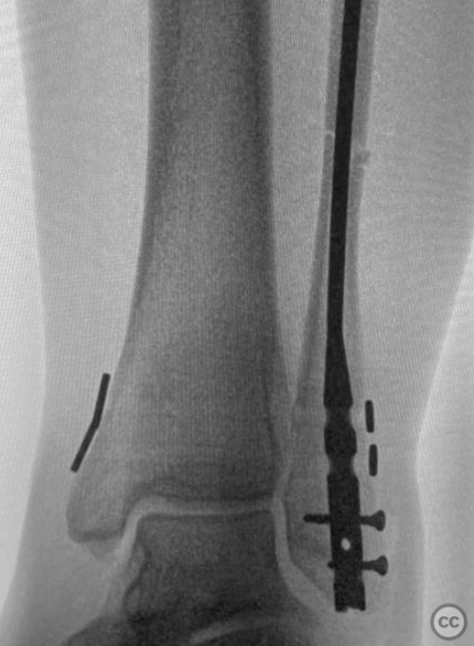 case image