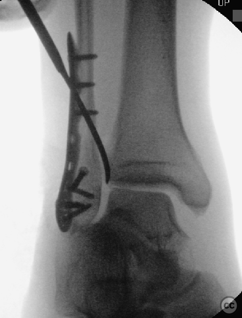 case image