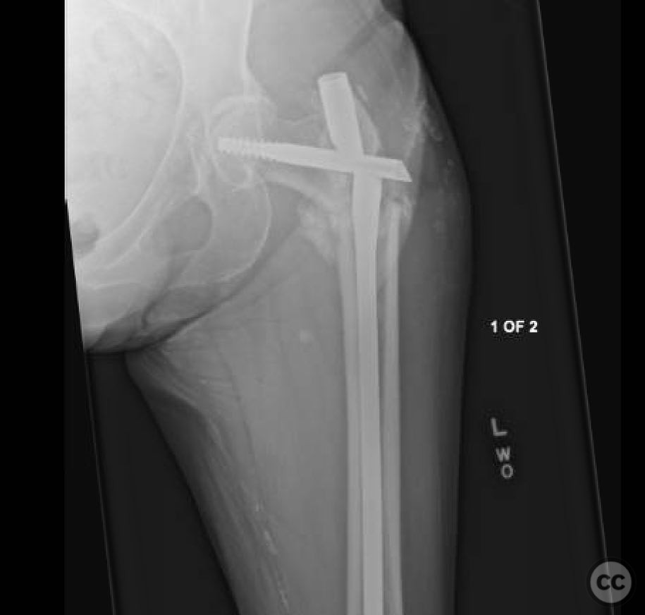 case image