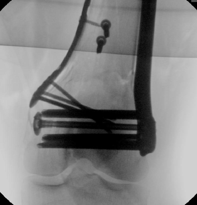 case image