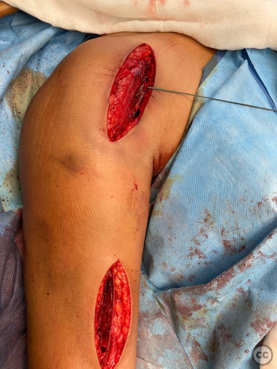 case image