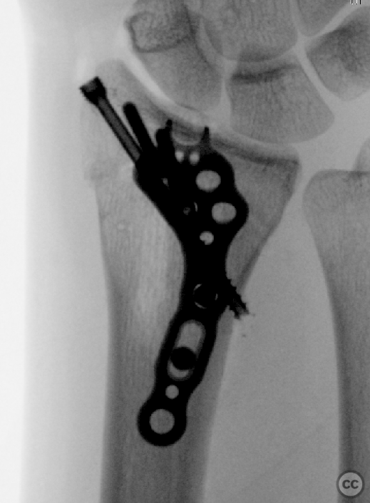 case image