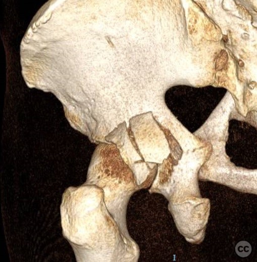 case image