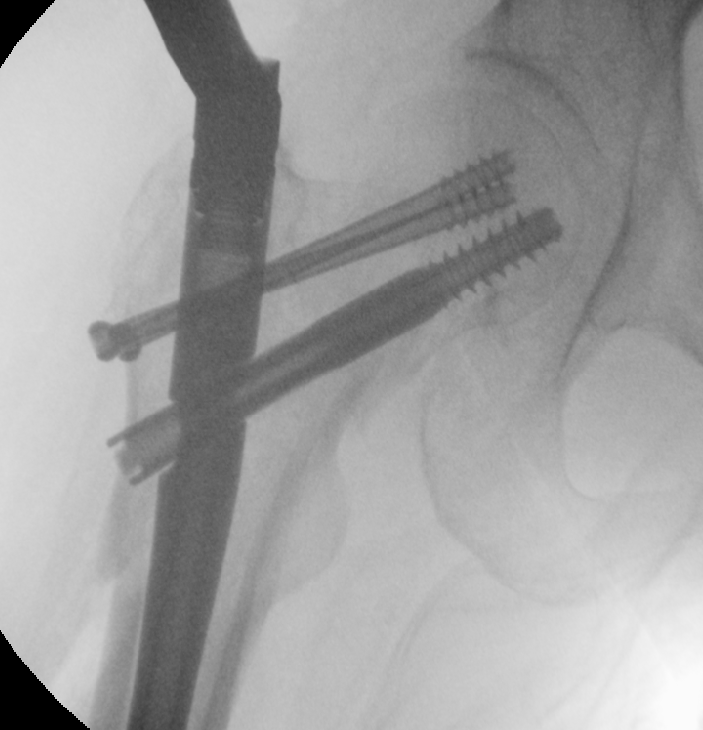 case image