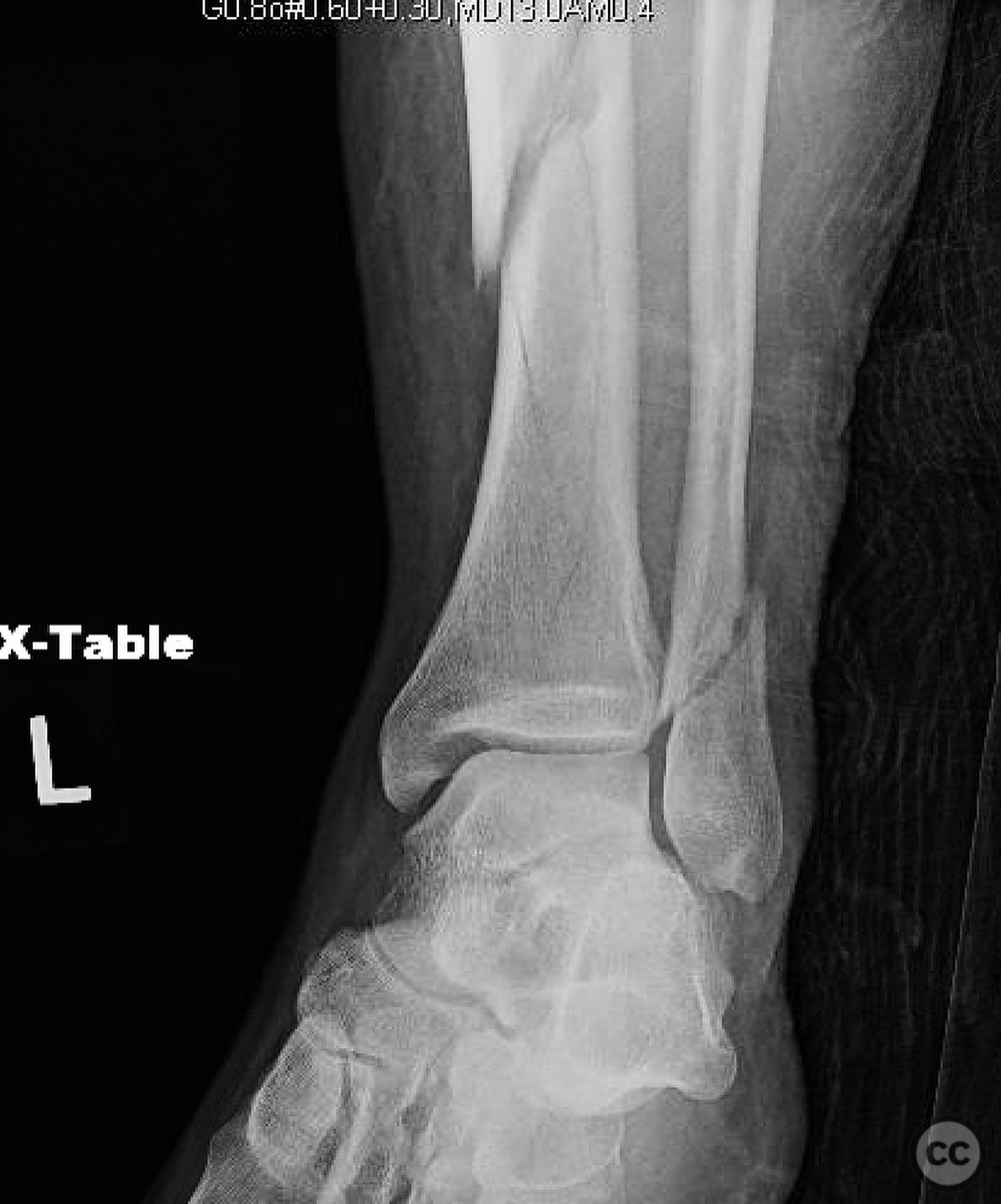 case image