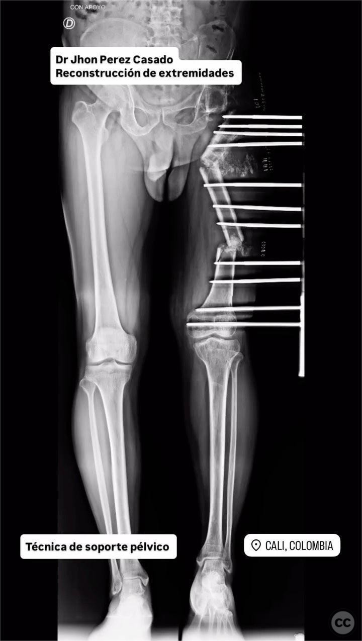 case image