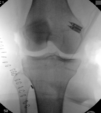 case image