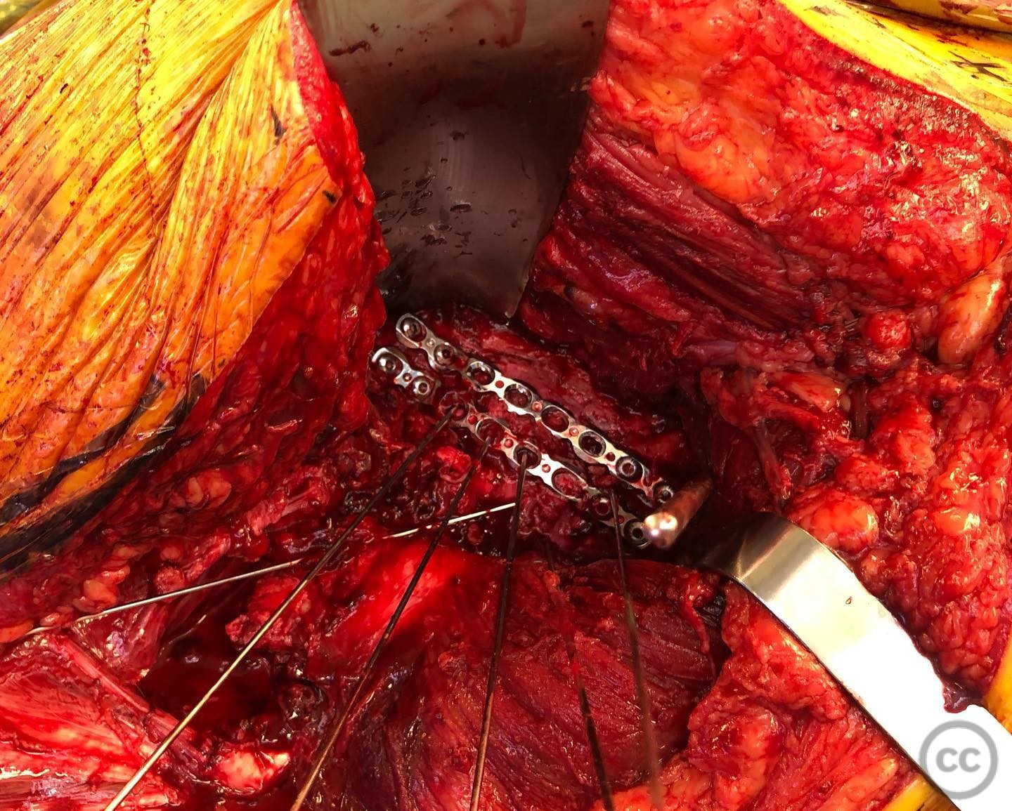 case image
