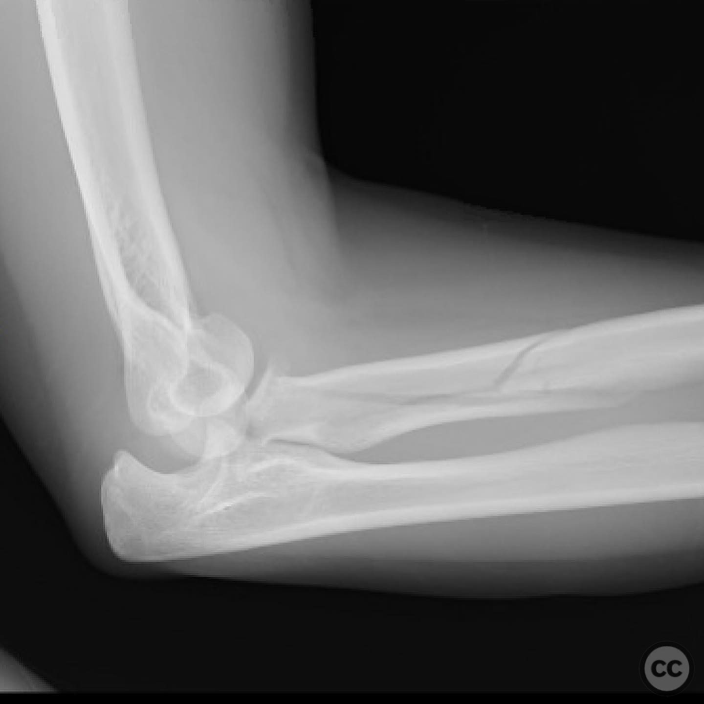 case image