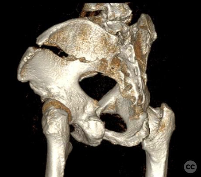 case image