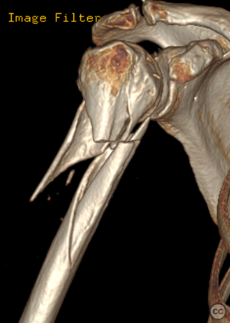 case image