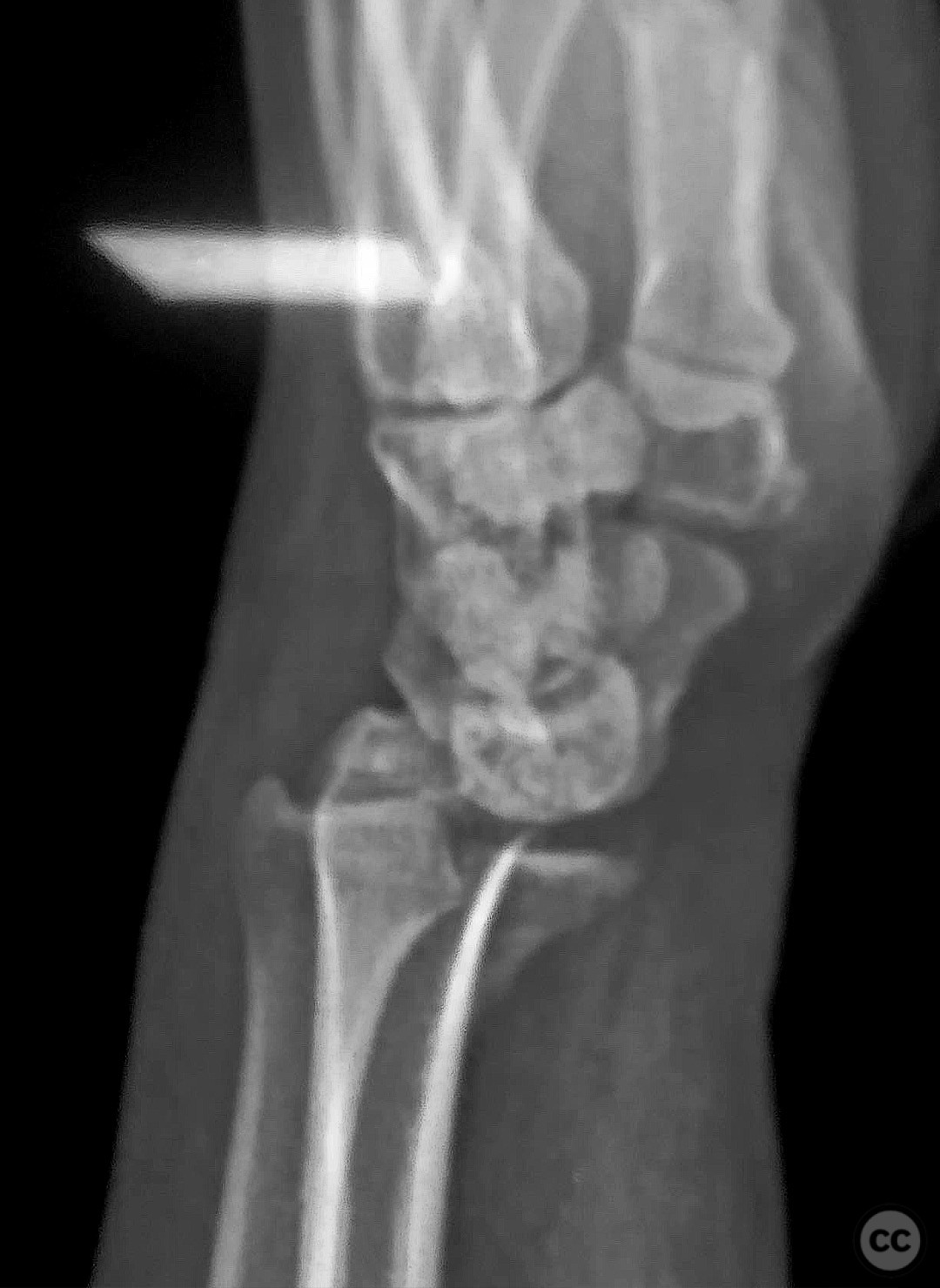 case image