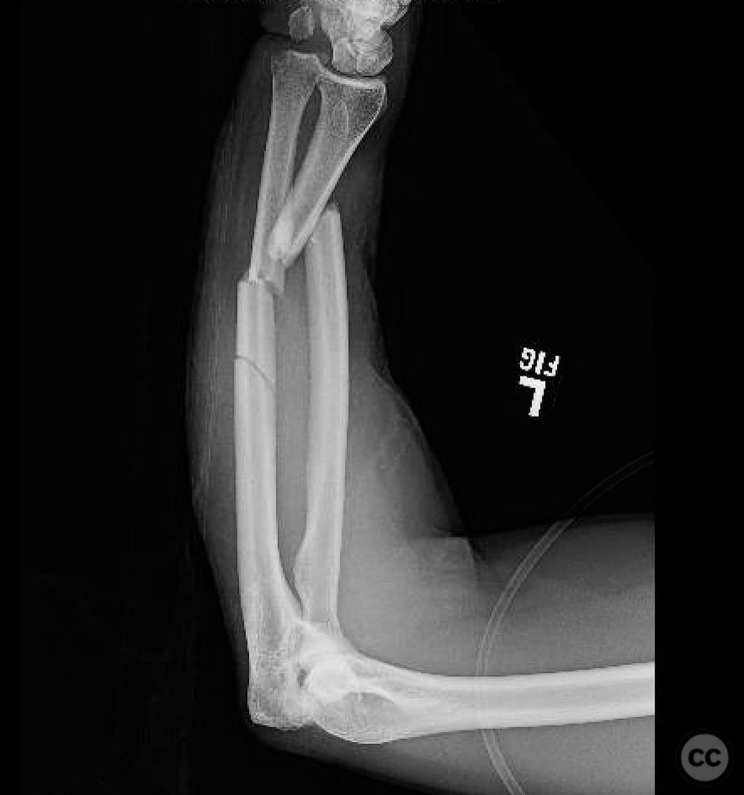 case image