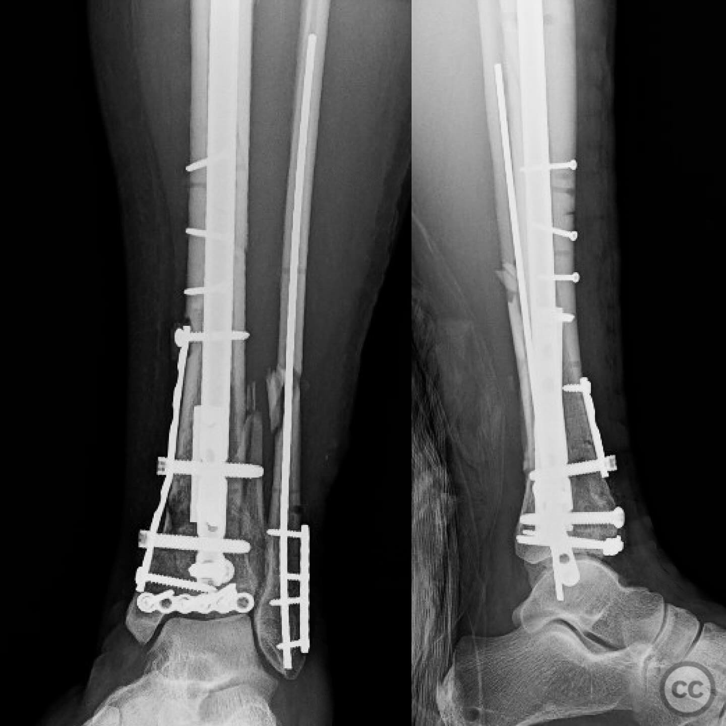 case image