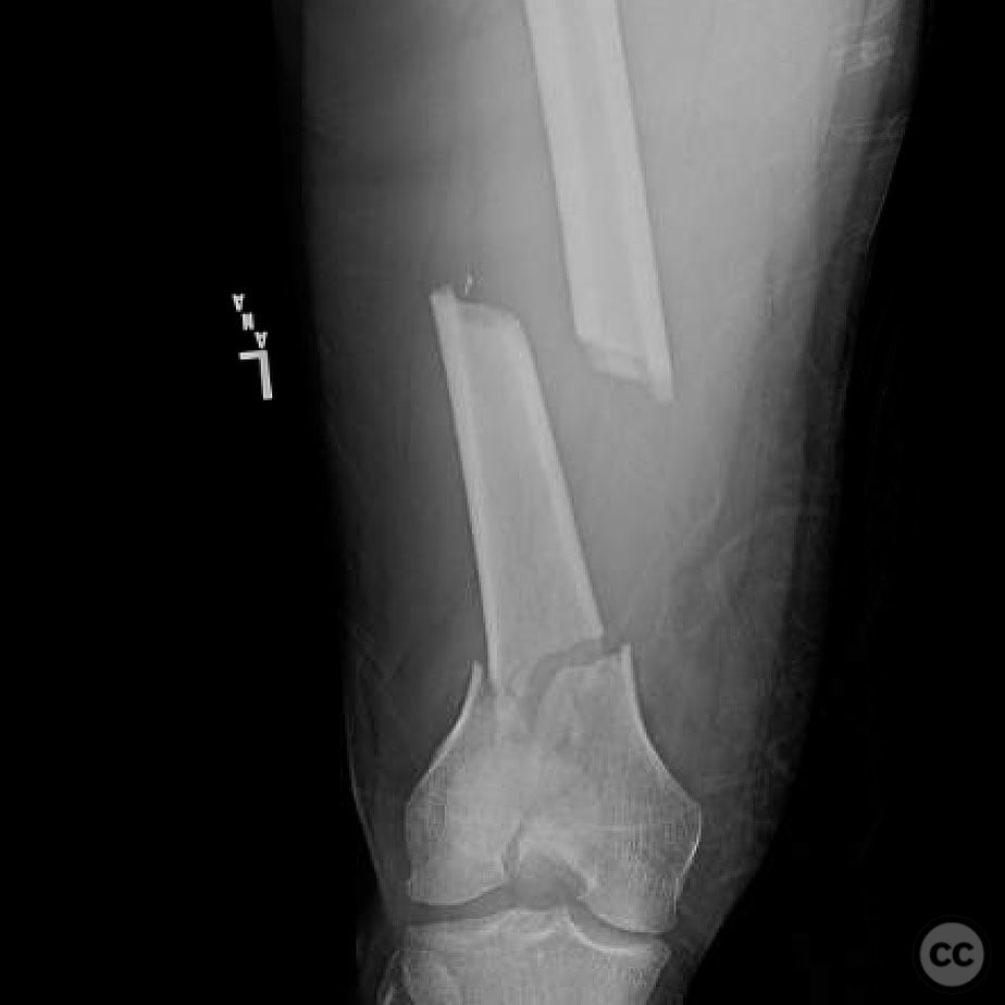 case image