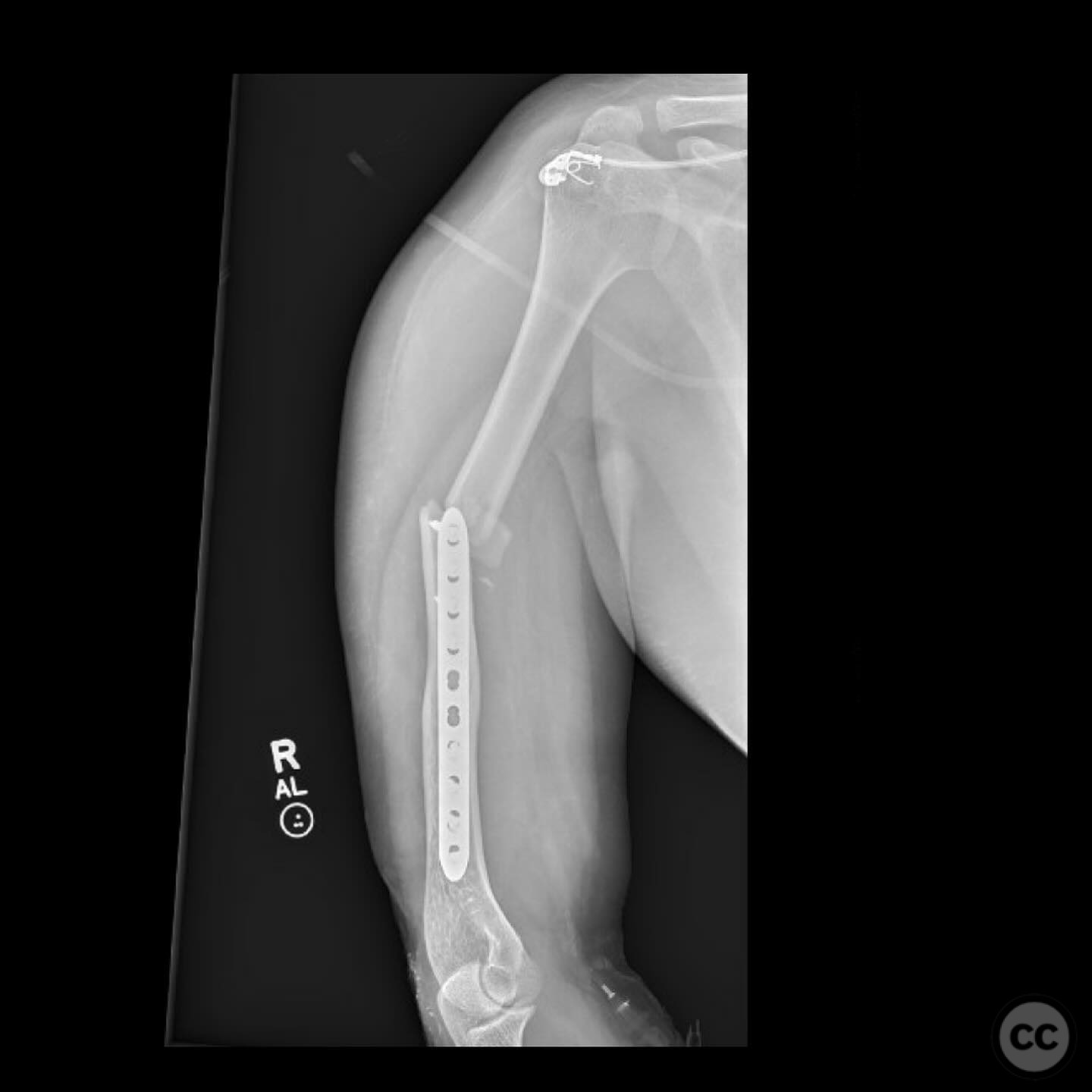 case image