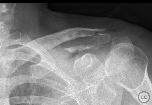 case image