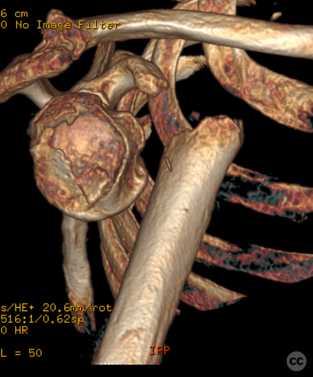case image