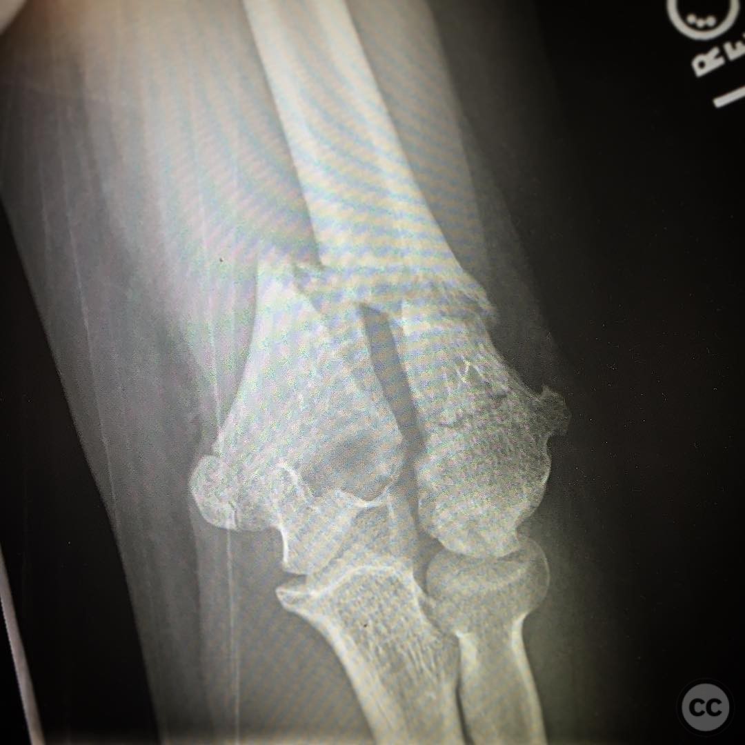 case image