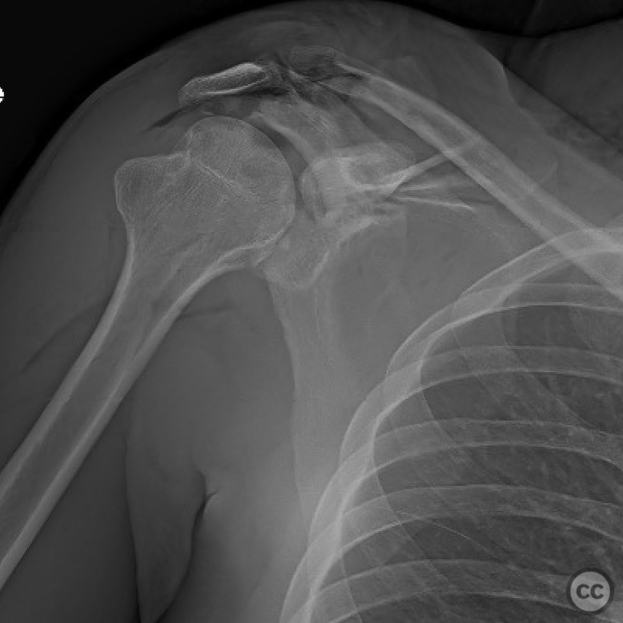case image