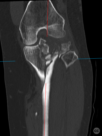 case image