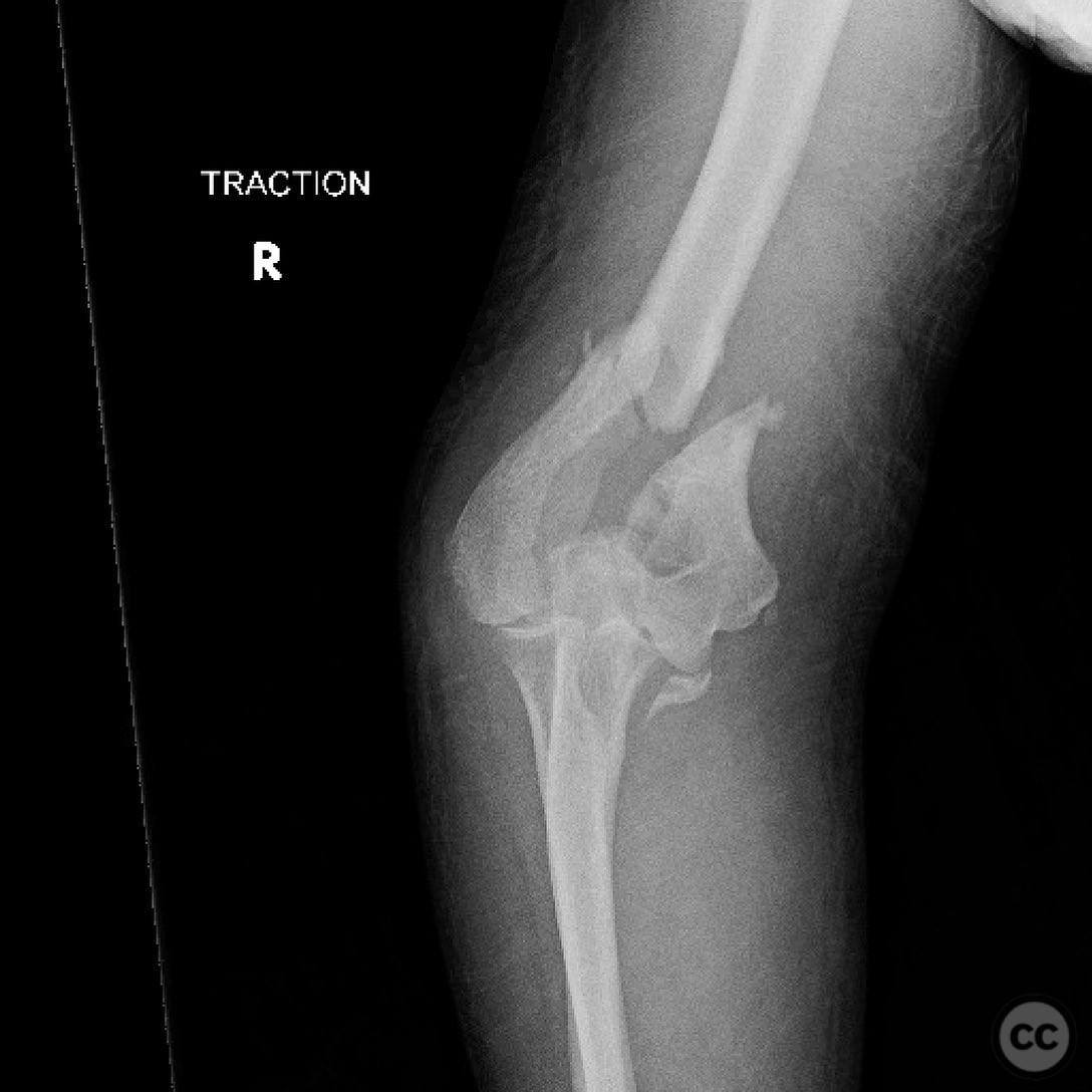 case image