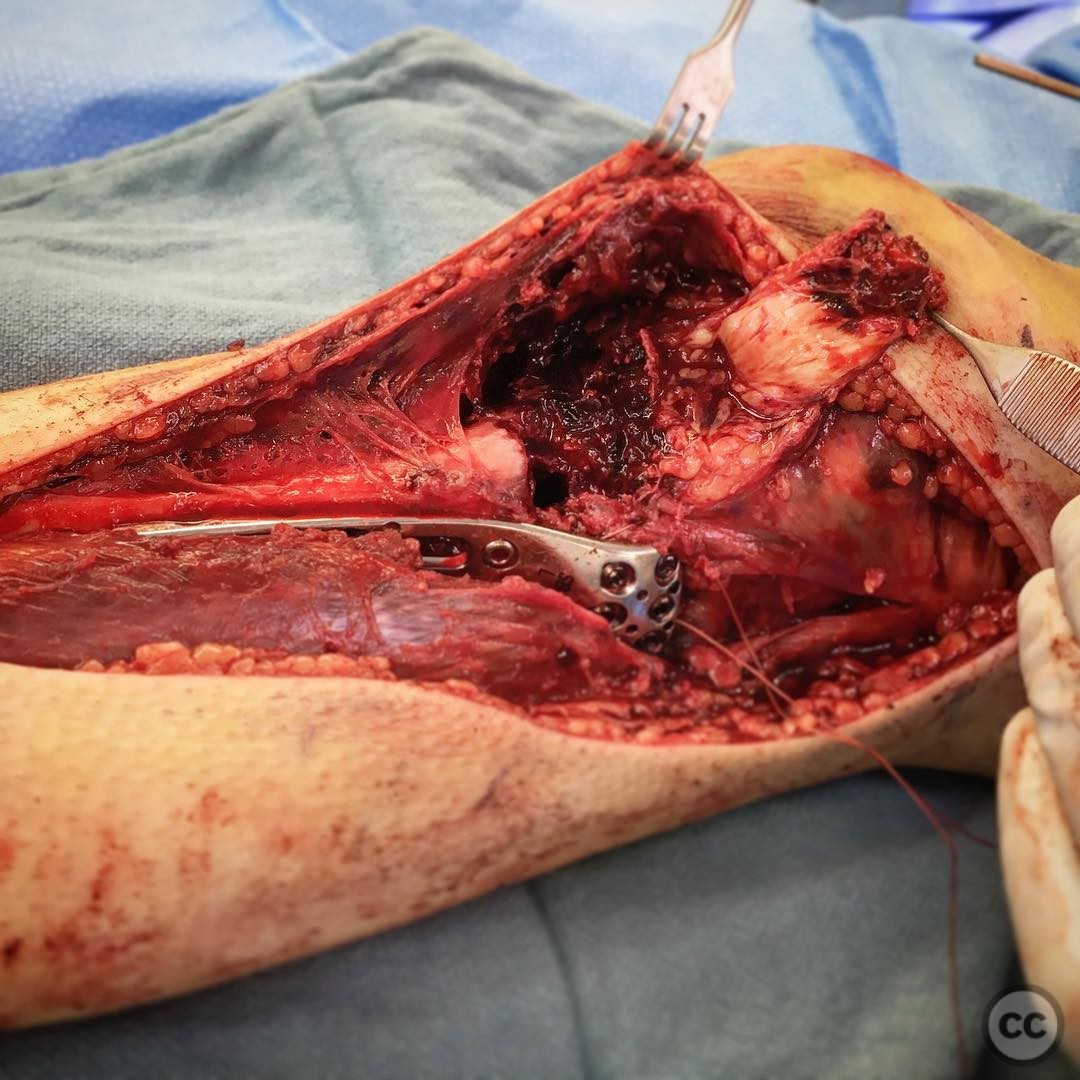 case image