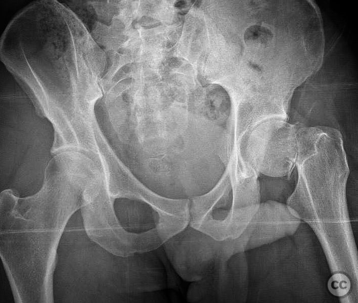 case image