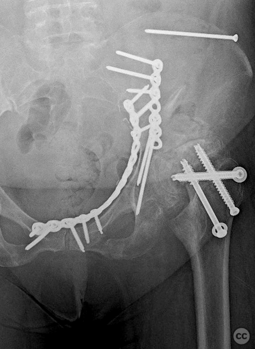 case image