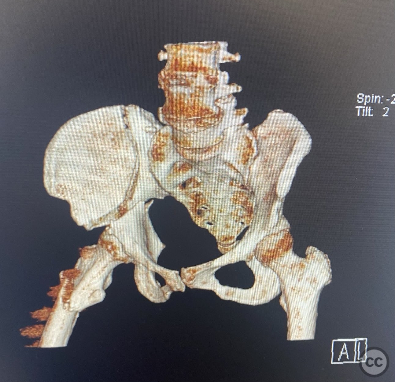 case image