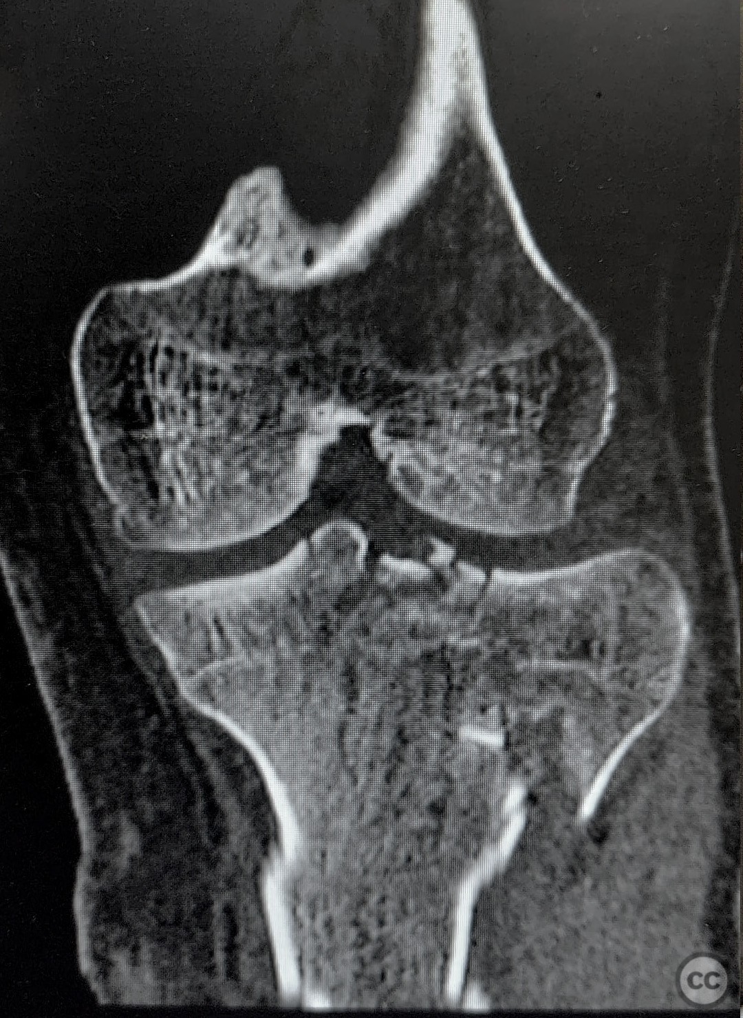 case image
