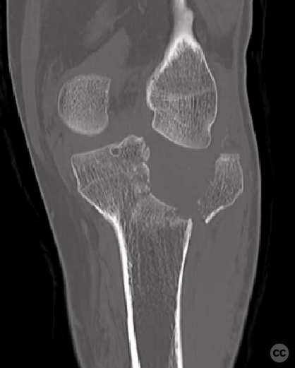 case image