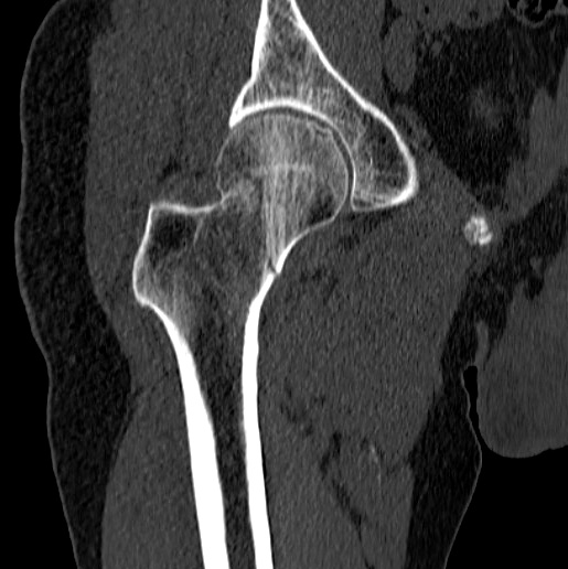 case image