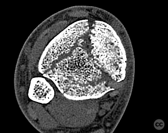 case image