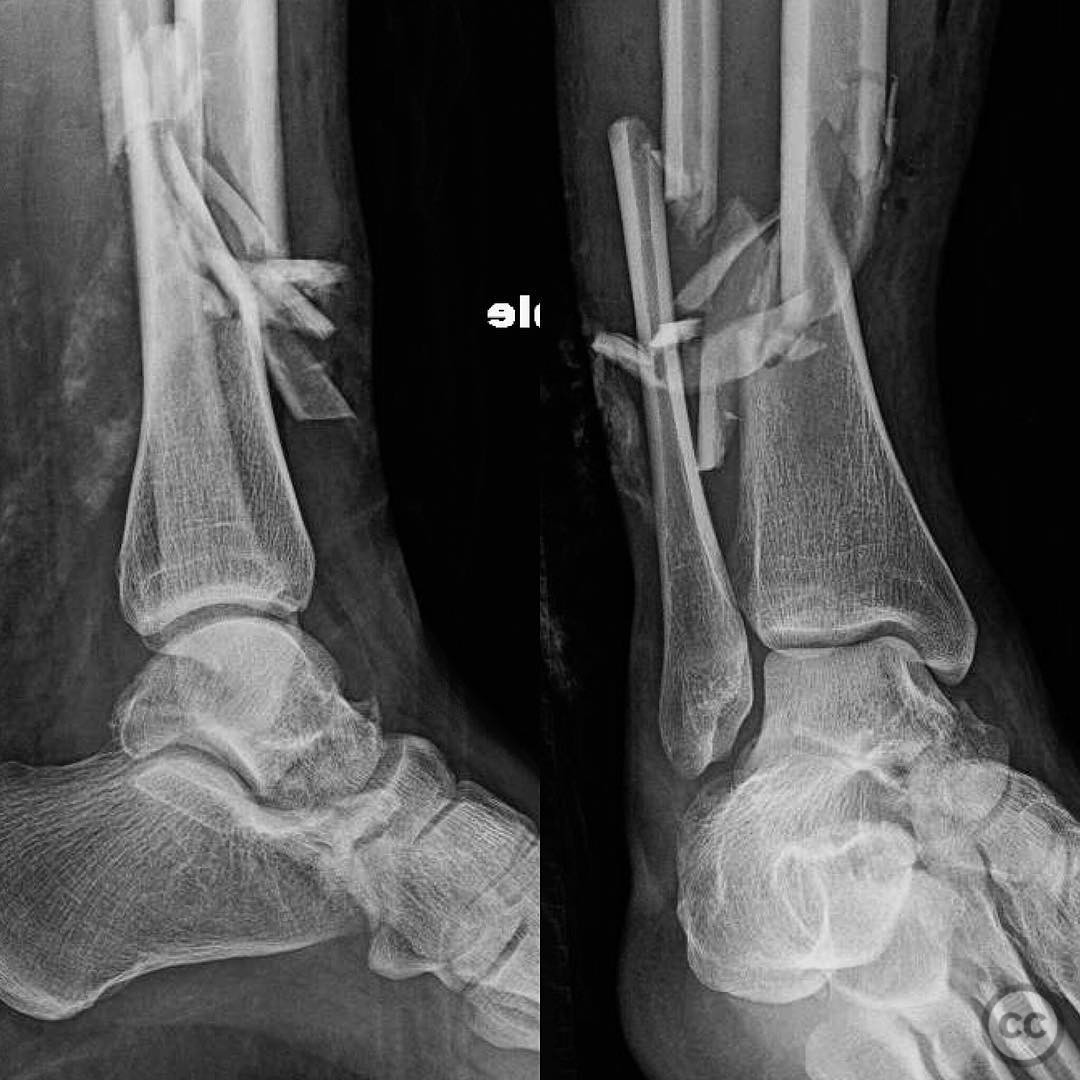 case image