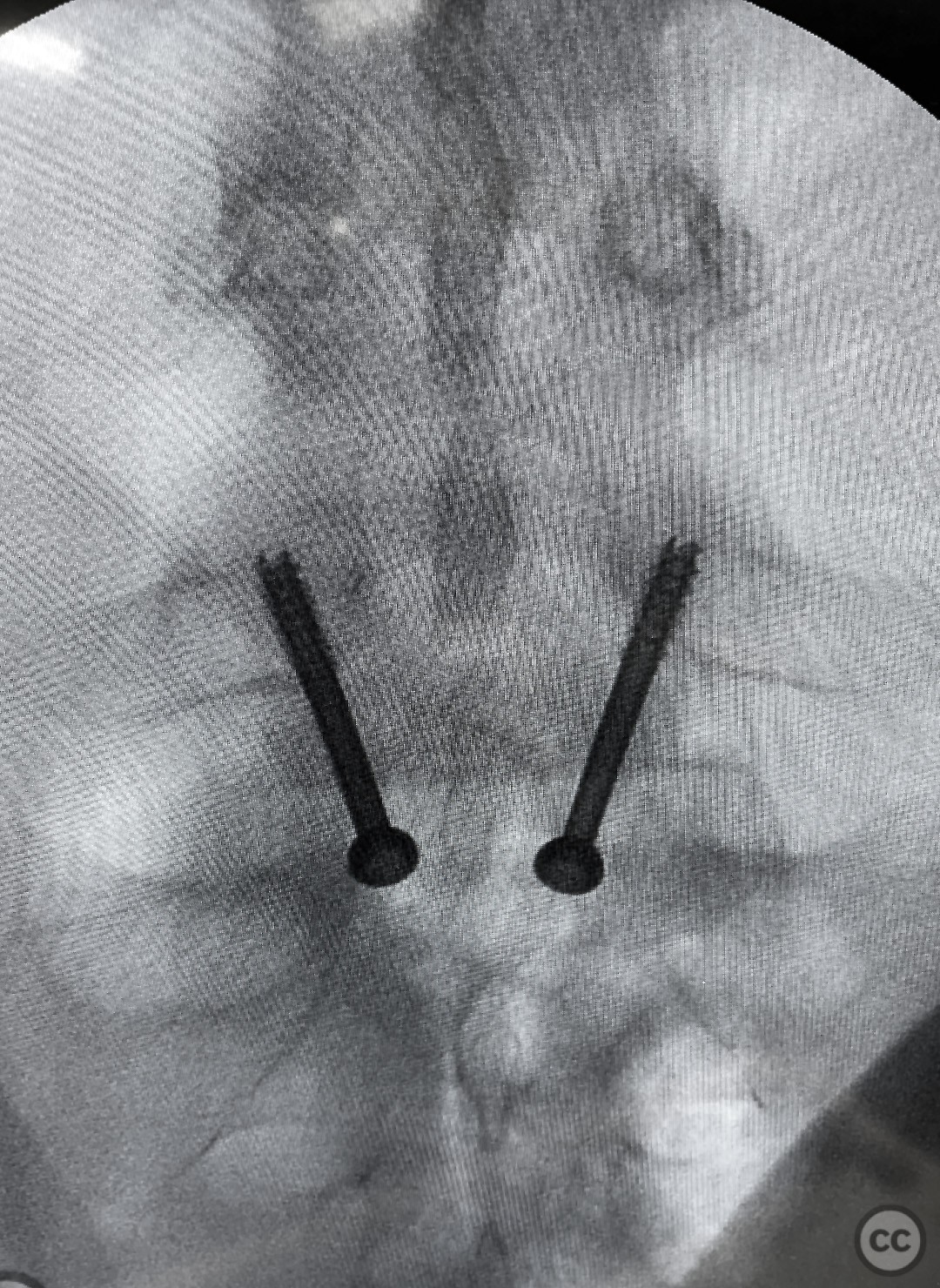 case image