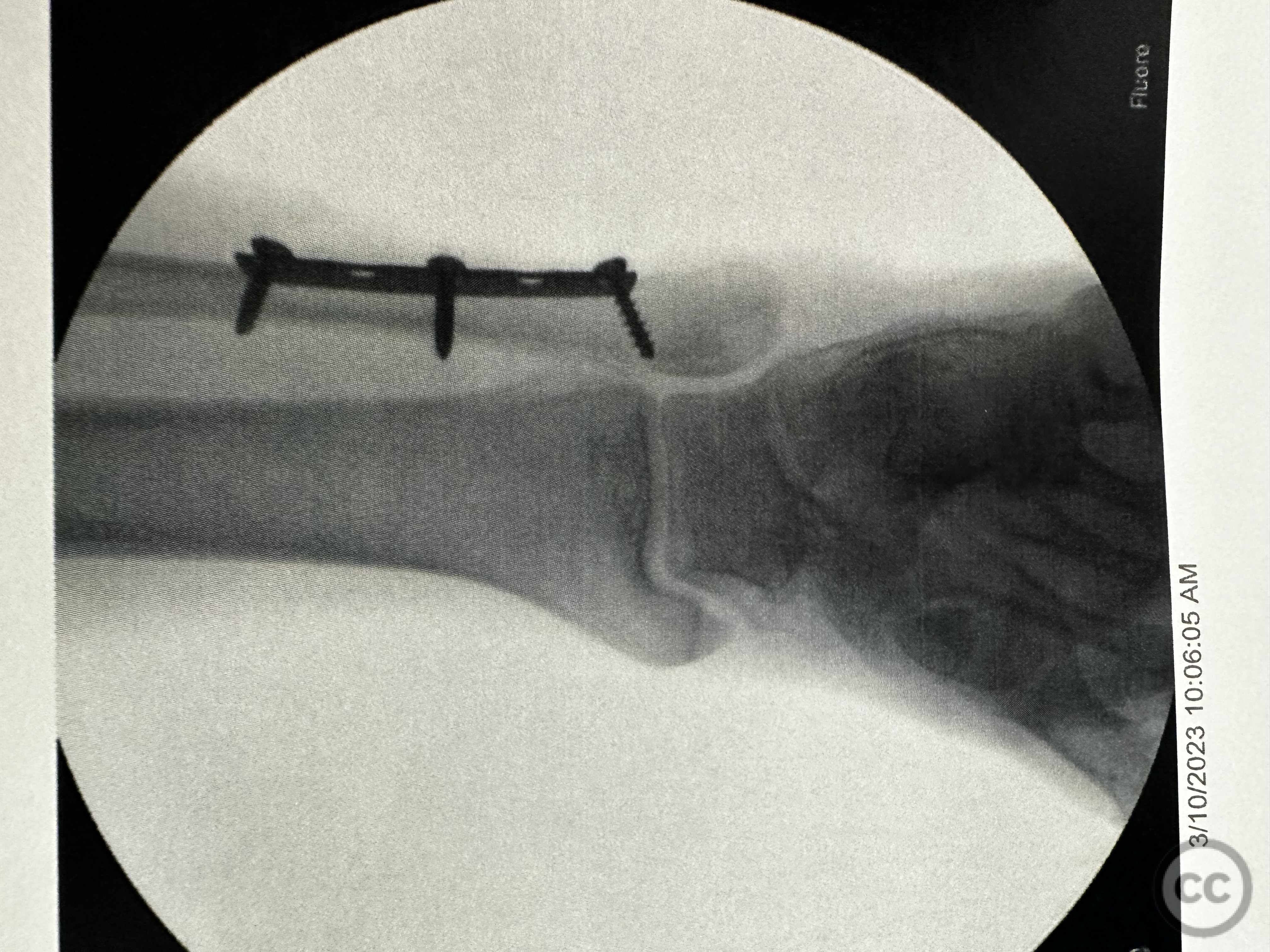 case image